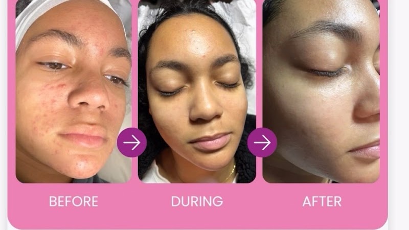 Marilene's Day Spa, skin care clinic in Somerville, MA, photo 3 of 10